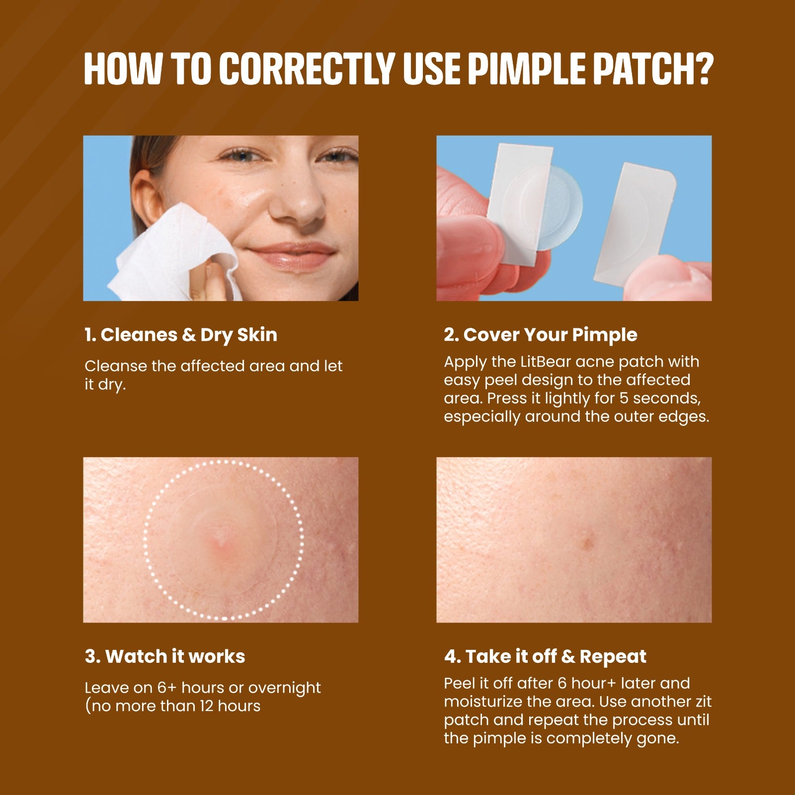 COANC Pimple Patches Extra Small Daytime Hydrocolloid